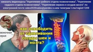 Закидывание головы губит шею, зажимает главные сосуды шеи и мозга. Упражнения