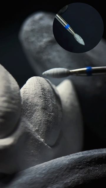 Подпишись ♥️ Учись, практикуй, улучшай качество реставраций и повышай свой прайс со мной 🦷♥️