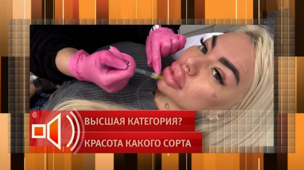 Гиалуроновая долина: девушка с самыми большими в России губами рассказала, сколько тратит на свою...