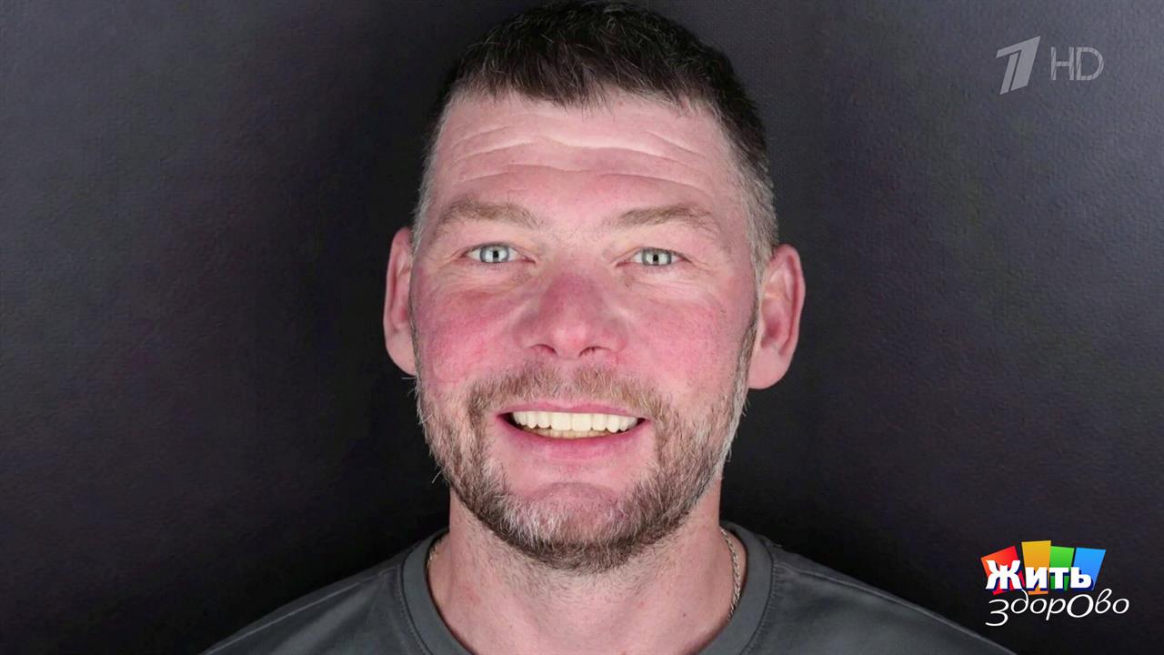 Жизнь без зубов: когда улыбка возвращается. Жить здорово! Фрагмент выпуска от 19.02.2026 смотреть онлайн