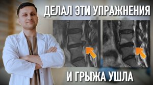 Я ВЫЛЕЧИЛ ГРЫЖУ В СПИНЕ ЭТИМИ УПРАЖНЕНИЯМИ (без уколов и операций)