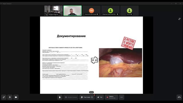Лекция: Концепция «Безопасная герниология». Кащенко В.А. смотреть онлайн