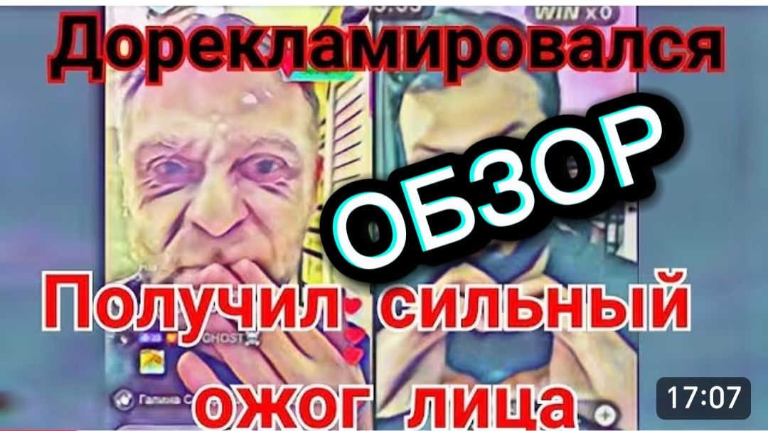САМВЕЛ АДАМЯН, ОБЗОР, ПОЛУЧИЛ СИЛЬНЫЙ ОЖОГ, ВСЕ ПЛОХО, ПОИСКИ КАРДИОЛОГА.. смотреть онлайн