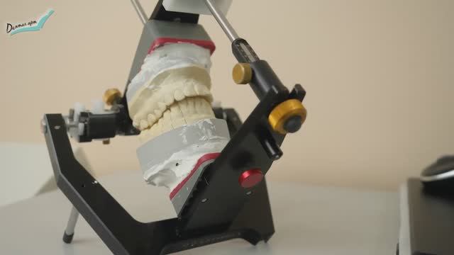 Прием гнатолога. Диагностические методы