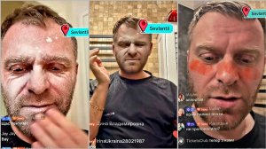 Оппек Лицо Косметикой Много Мазал Шо Теперь Робыть Злазыть Кожа Самвел Адамян