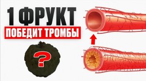 ЭТОТ продукт очищает сосуды от бляшек и тромбов лучше щетки! / ОБЯЗАТЕЛЬНО всем в 30+