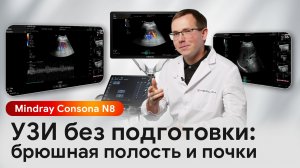 УЗИ брюшной полости неподготовленного пациента с ожирением: Mindray Consona N8