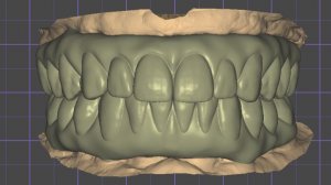 Тотал по Слачивеку верх низ