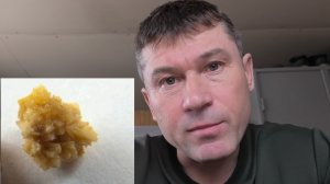 Я сам вывел камень из почки ХОТЯ ВРАЧ СКАЗАЛ ЧТО ЭТО НЕВОЗМОЖНО  мой метод предостережения от камней