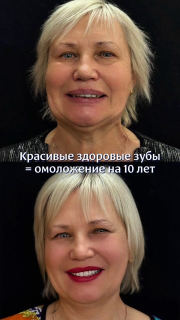 Результат до и после смотреть онлайн