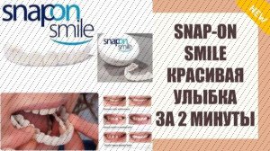 😬 Элайнеры фото на людях реальные