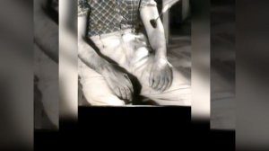 Полинейропатия