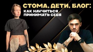 Стома — не приговор: история девушки, которая приняла себя