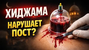НАРУШАЕТ ЛИ ПОСТ КРОВОПУСКАНИЕ? | Доктор Ясир аль-Надджар