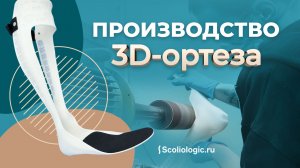 Ортезы, напечатанные на 3D-принтере. Лучше или хуже?