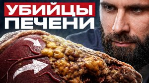 6 привычек для здоровой ПЕЧЕНИ – научно доказано!