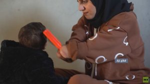 مبتورو الأطراف.. قصص تجسد بشاعة الحرب