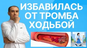 Растворила тромб благодаря ходьбе. Флеболог Москва.