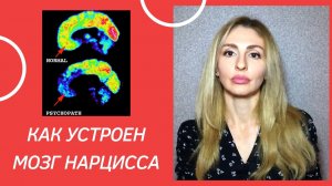 🔺Как устроен мозг Нарцисса🔻