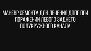 Маневр СЕМОНТА для лечения ДППГ при поражении левого заднего полукружного канала
