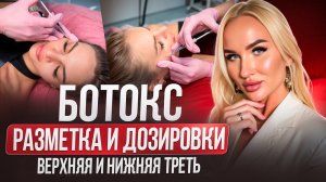 Ботокс. Разметка и дозировки. Верхняя и нижняя треть