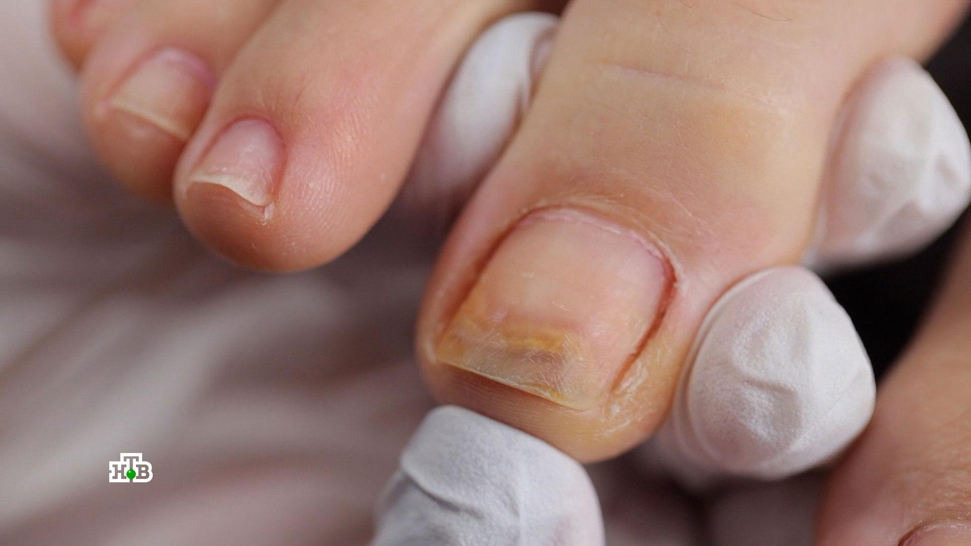 Нужно ли давать ногтям отдыхать от гель-лака? | «Чудо техники» смотреть онлайн