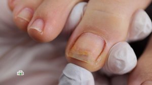 Нужно ли давать ногтям отдыхать от гель-лака? | «Чудо техники»