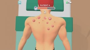 давим мультяшные прыщи игра развлекательное видео для детей