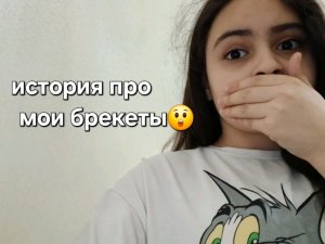 ﹤﹤история про мои брекеты😲﹥﹥ Люся рассказывает жуть о своих брекетах