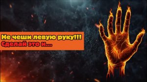ЭТИ СИГНАЛЫ — ПРЕДУПРЕЖДЕНИЕ! Если чешется левая ладонь