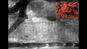 Микроциркуляция крови