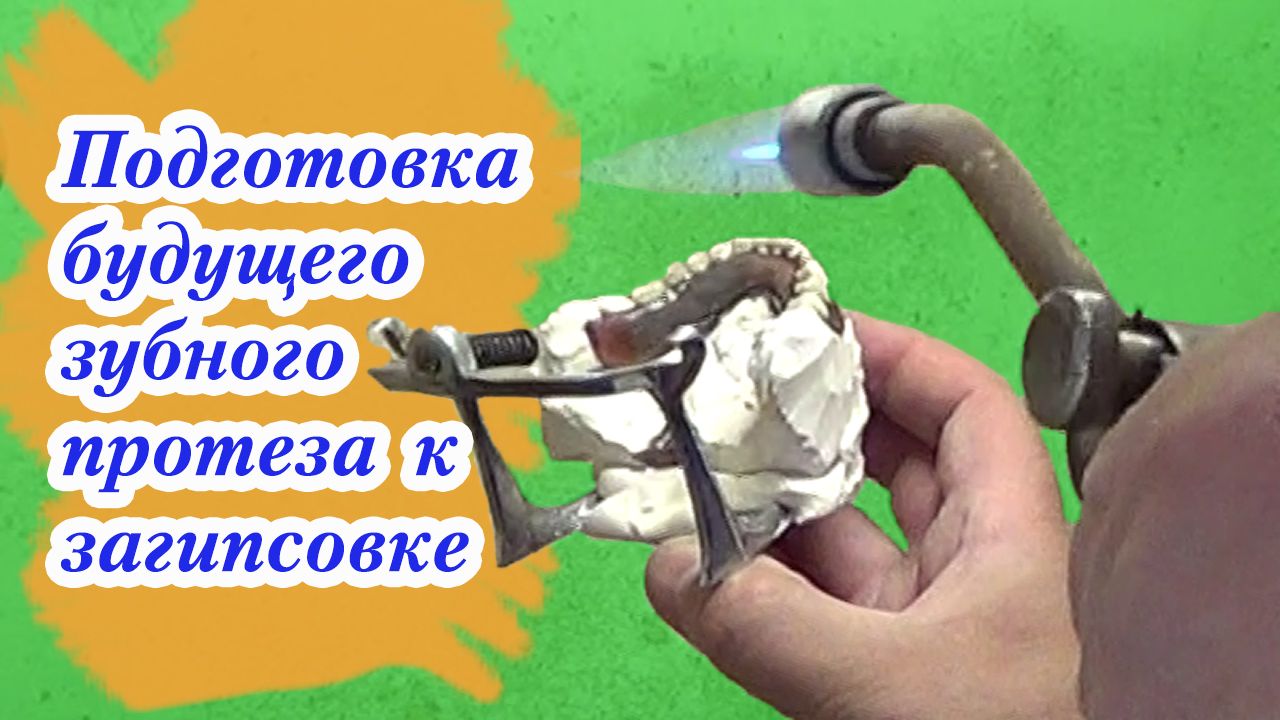 Подготовка постановки будущего съёмного зубного протеза к загипсовке и гипсовка в кювету смотреть онлайн
