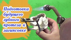 Подготовка постановки будущего съёмного зубного протеза к загипсовке и гипсовка в кювету