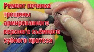 Ремонт починка трещины армированного верхнего съёмного зубного протеза