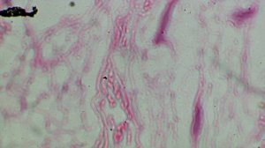 Кожа человека под микроскопом (вторая версия)