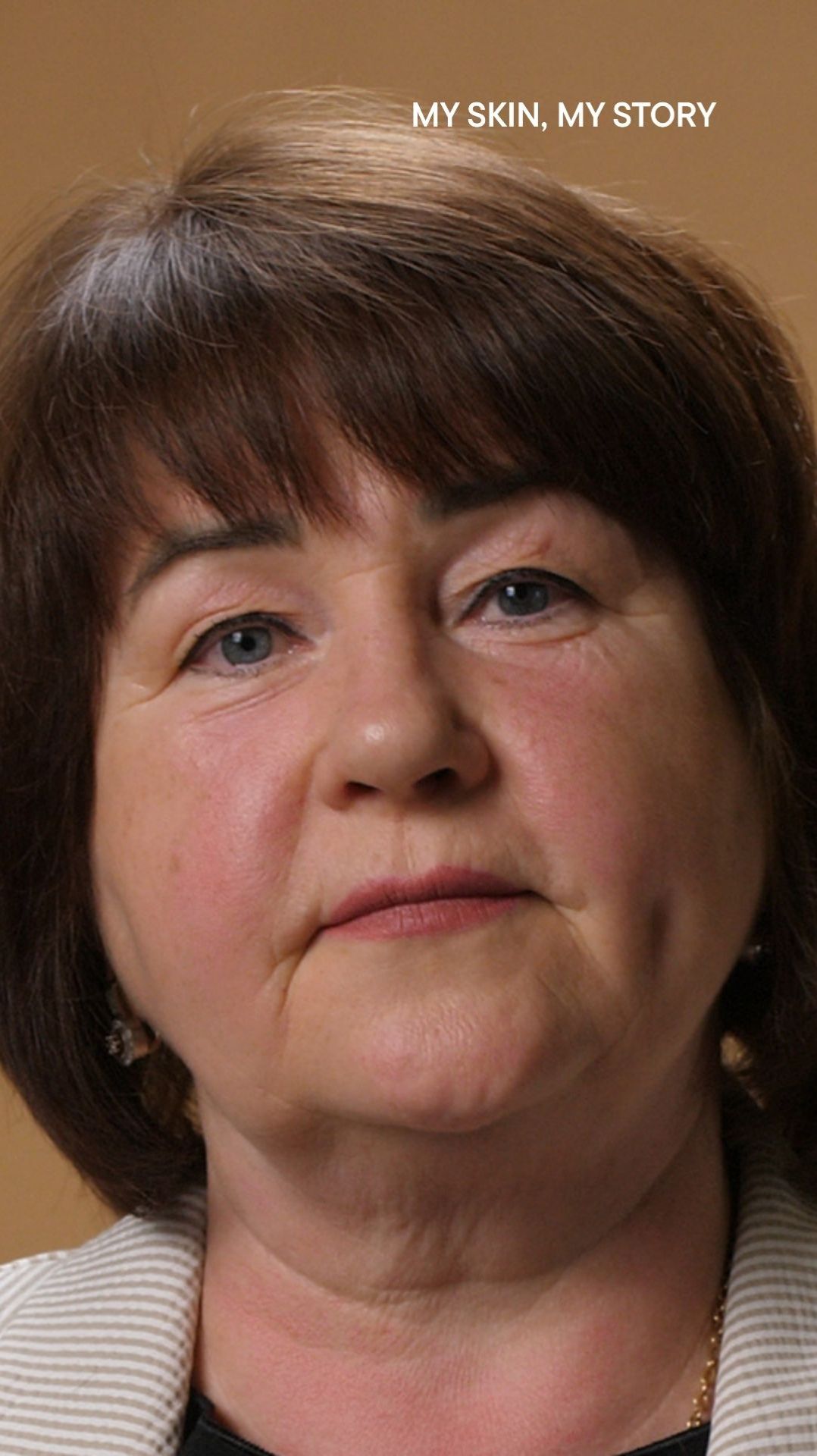 BABOR_MY SKIN, MY STORY: снижение морщин и восстановление комфорта кожи