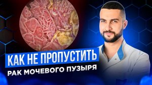 Рак мочевого пузыря | Какие симптомы нельзя игнорировать