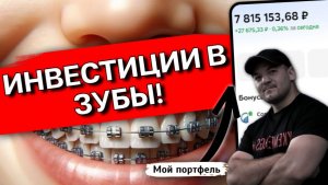 Инвестиции в зубы: сколько я потратил на брекеты за 2 года и есть ли результат?