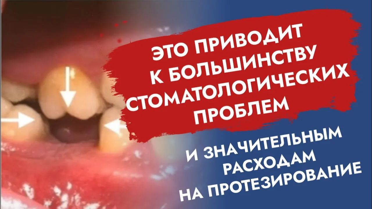 Как cэкономить на протезировании? Это работает!