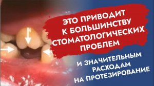 Как cэкономить на протезировании? Это работает!