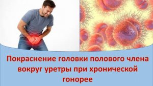 Покраснение головки полового члена вокруг уретры при хронической гонорее