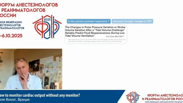 Как мониторить сердечный выброс без монитора Xavier Monnet 2025 смотреть онлайн