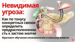 Невидимая угроза: Как по тонусу конкретных связок определить предрасположенность к застою желчи.