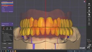 Применение анализа модели