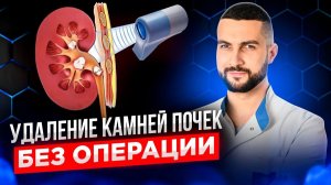Дистанционная литотрипсия - плюсы и минусы удаления камней почек без операции