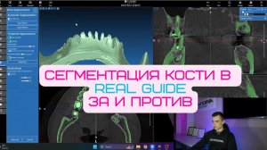 Сегментация кости в Real Guide. Можно ли работать по кости?