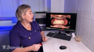 вариант тв еа + аю