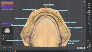 Ориентиры для полно-съемного протеза