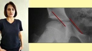 агрессивная растяжка