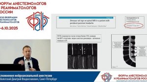 Осложнения нейроаксиальной анестезии Заболотский Д.В. 2025